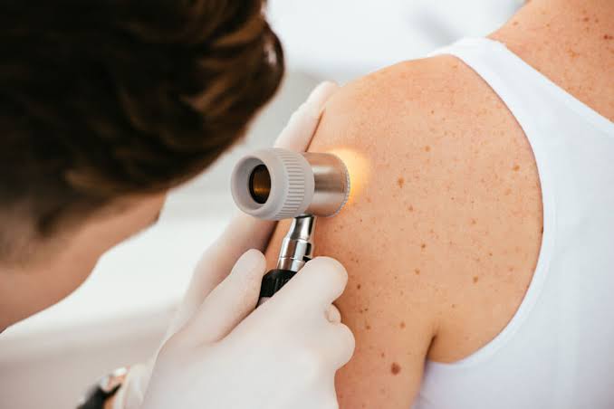 Dermatology