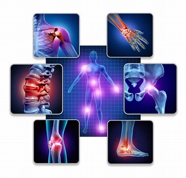 Orthopedics
